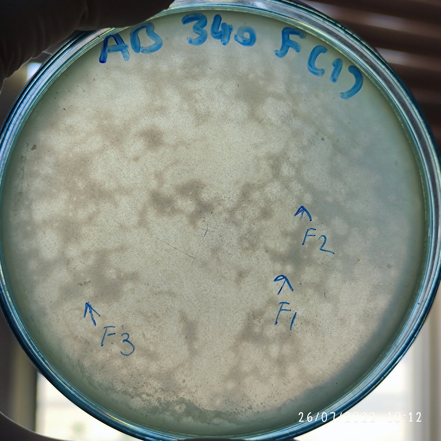 Acinetobacter baumannii bacteriophage 120340F