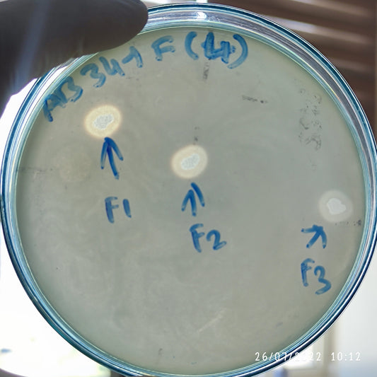 Acinetobacter baumannii bacteriophage 120341F