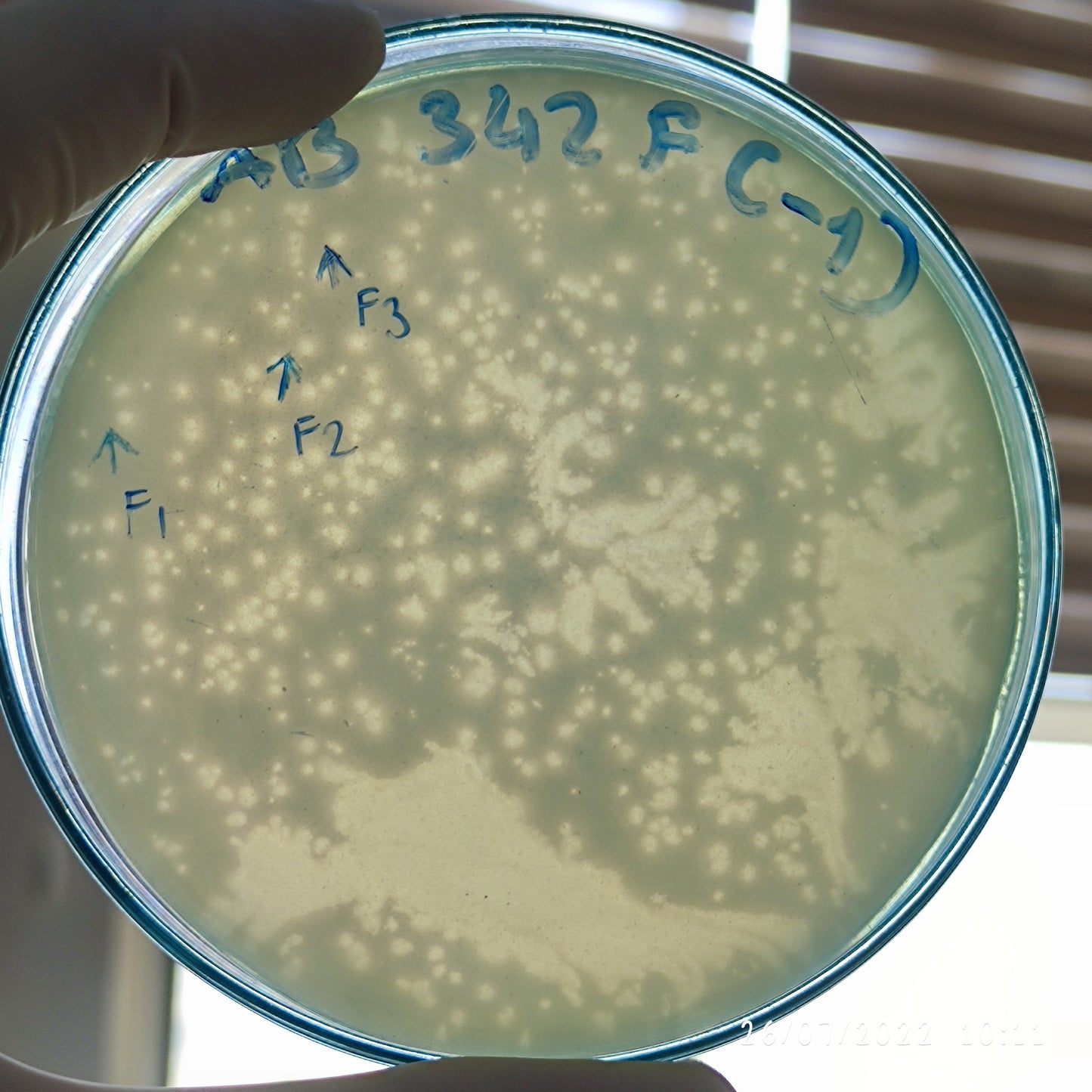 Acinetobacter baumannii bacteriophage 120342F