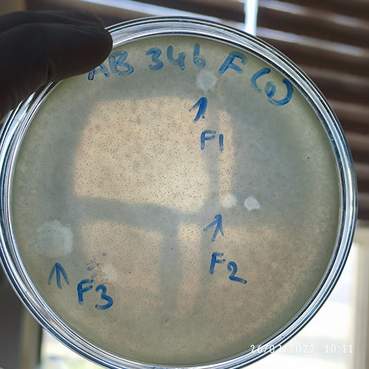 Acinetobacter baumannii bacteriophage 120346F