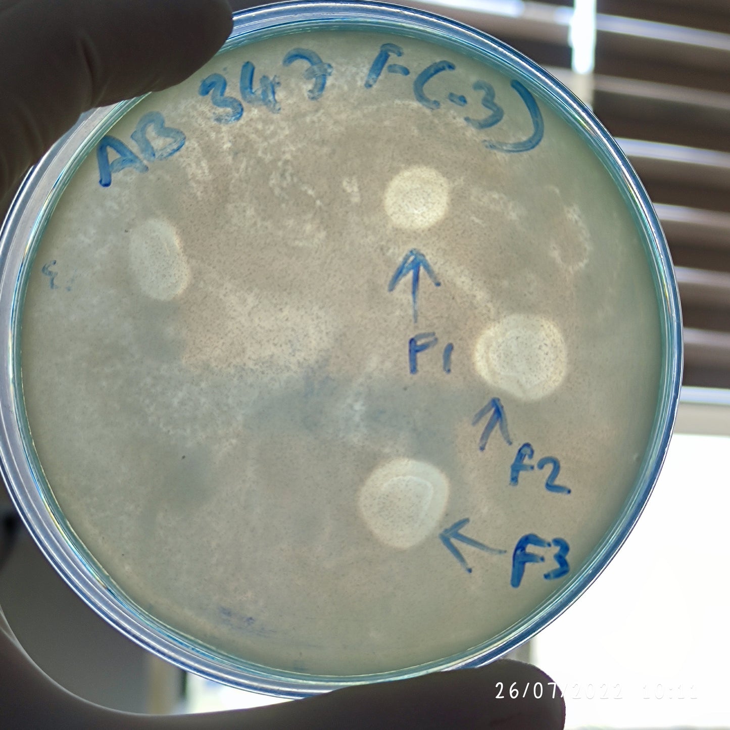 Acinetobacter baumannii bacteriophage 120347F