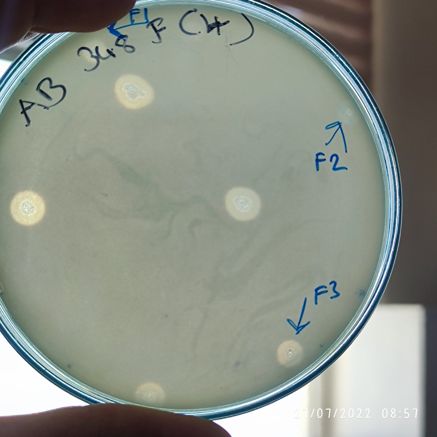 Acinetobacter baumannii bacteriophage 120348F