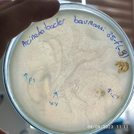 Acinetobacter baumannii bacteriophage 120035F