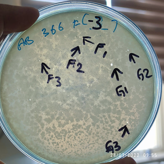 Acinetobacter baumannii bacteriophage 120366F