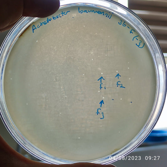 Acinetobacter baumannii bacteriophage 120036F