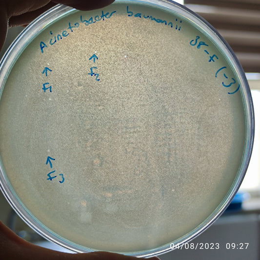 Acinetobacter baumannii bacteriophage 120038F