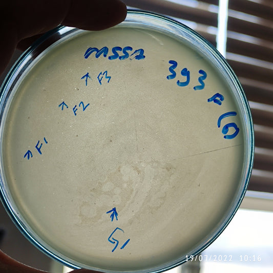 Staphylococcus aureus bacteriophage 152393G