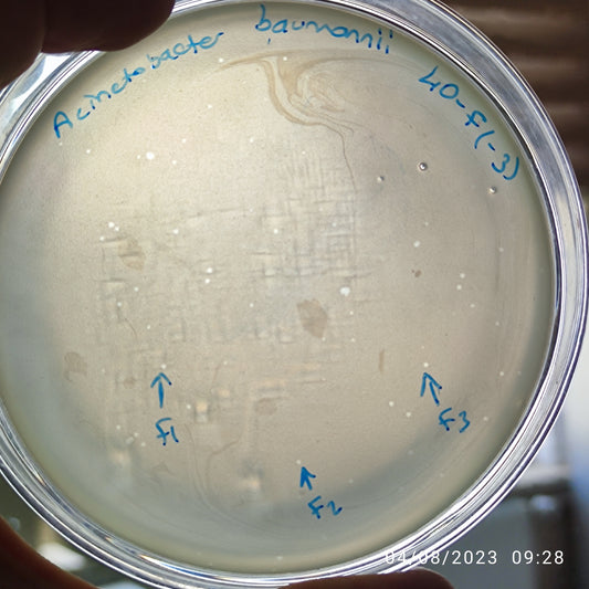 Acinetobacter baumannii bacteriophage 120040F