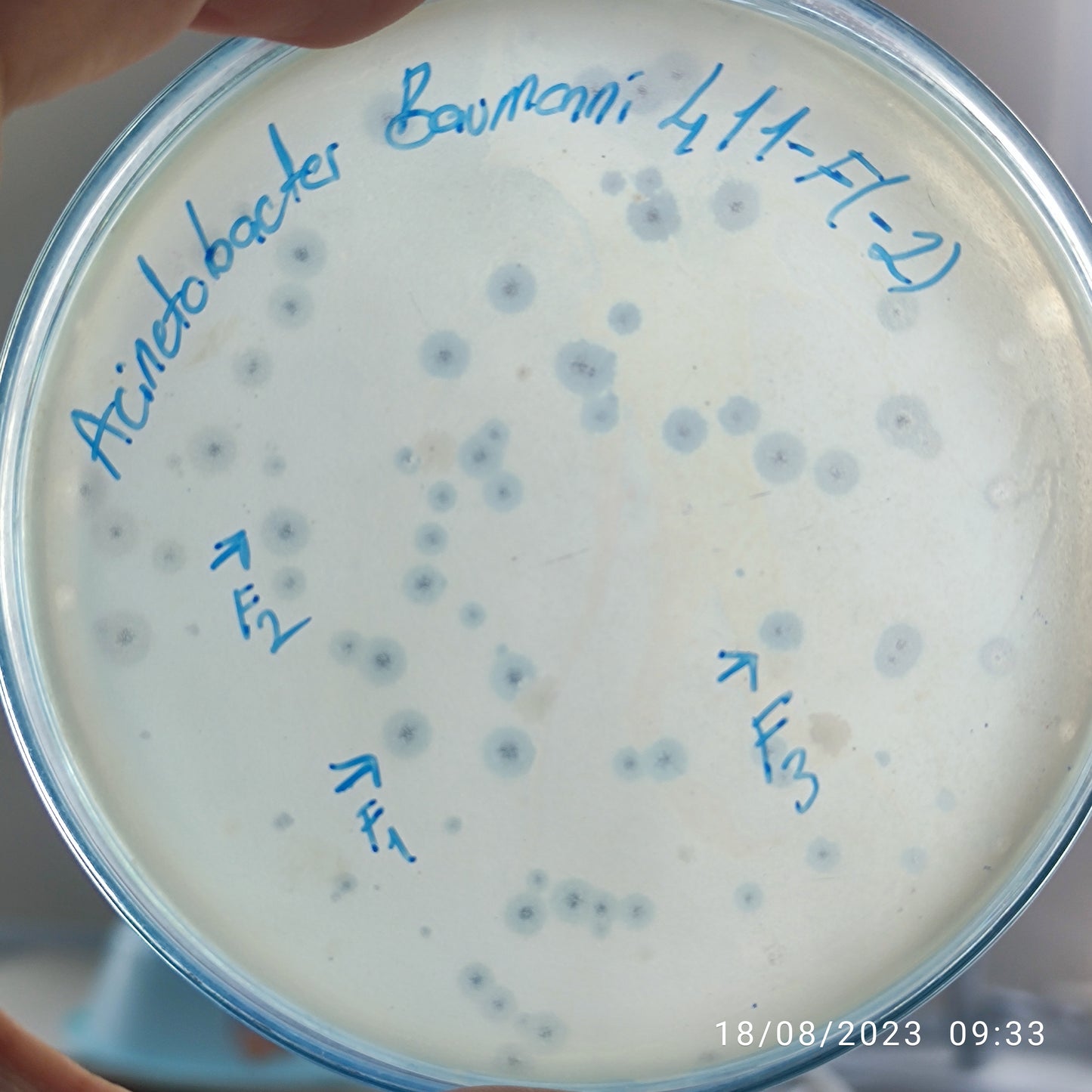 Acinetobacter baumannii bacteriophage 120411F