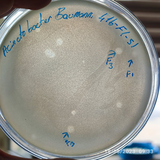 Acinetobacter baumannii bacteriophage 120416F