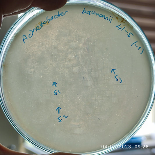 Acinetobacter baumannii bacteriophage 120041F