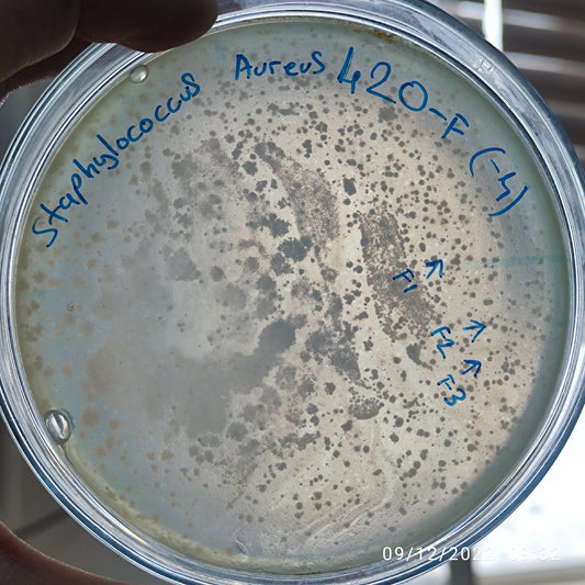 Staphylococcus aureus bacteriophage 152420F