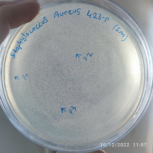 Staphylococcus aureus bacteriophage 152423F