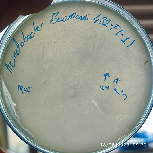 Acinetobacter baumannii bacteriophage 120432F