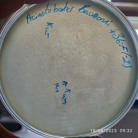 Acinetobacter baumannii bacteriophage 120436F