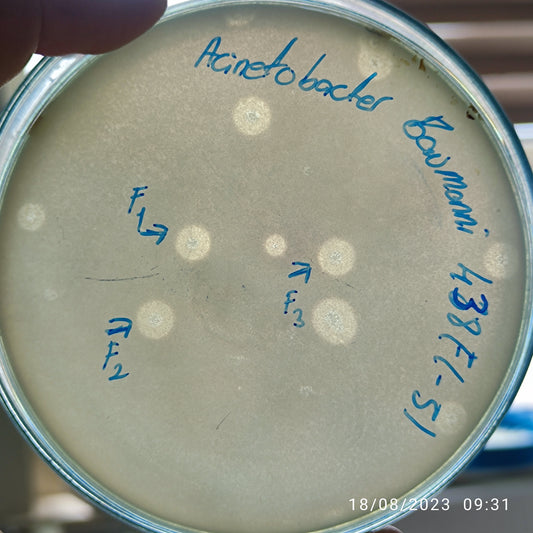 Acinetobacter baumannii bacteriophage 120438F