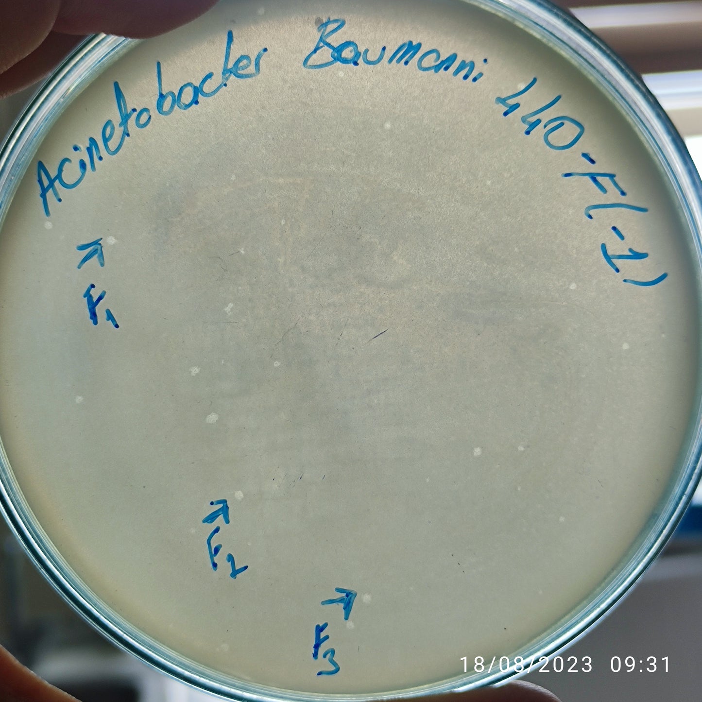 Acinetobacter baumannii bacteriophage 120440F