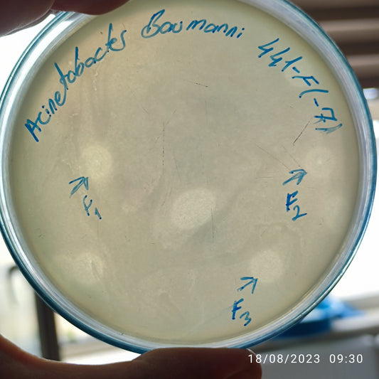 Acinetobacter baumannii bacteriophage 120441F