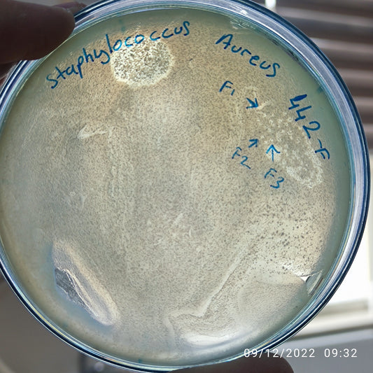 Staphylococcus aureus bacteriophage 152442F