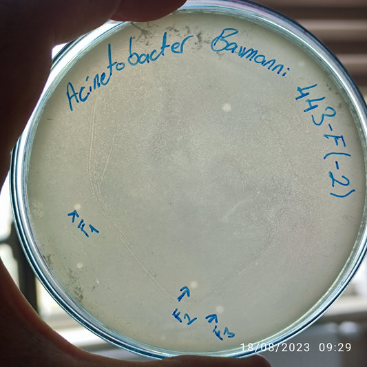 Acinetobacter baumannii bacteriophage 120443F