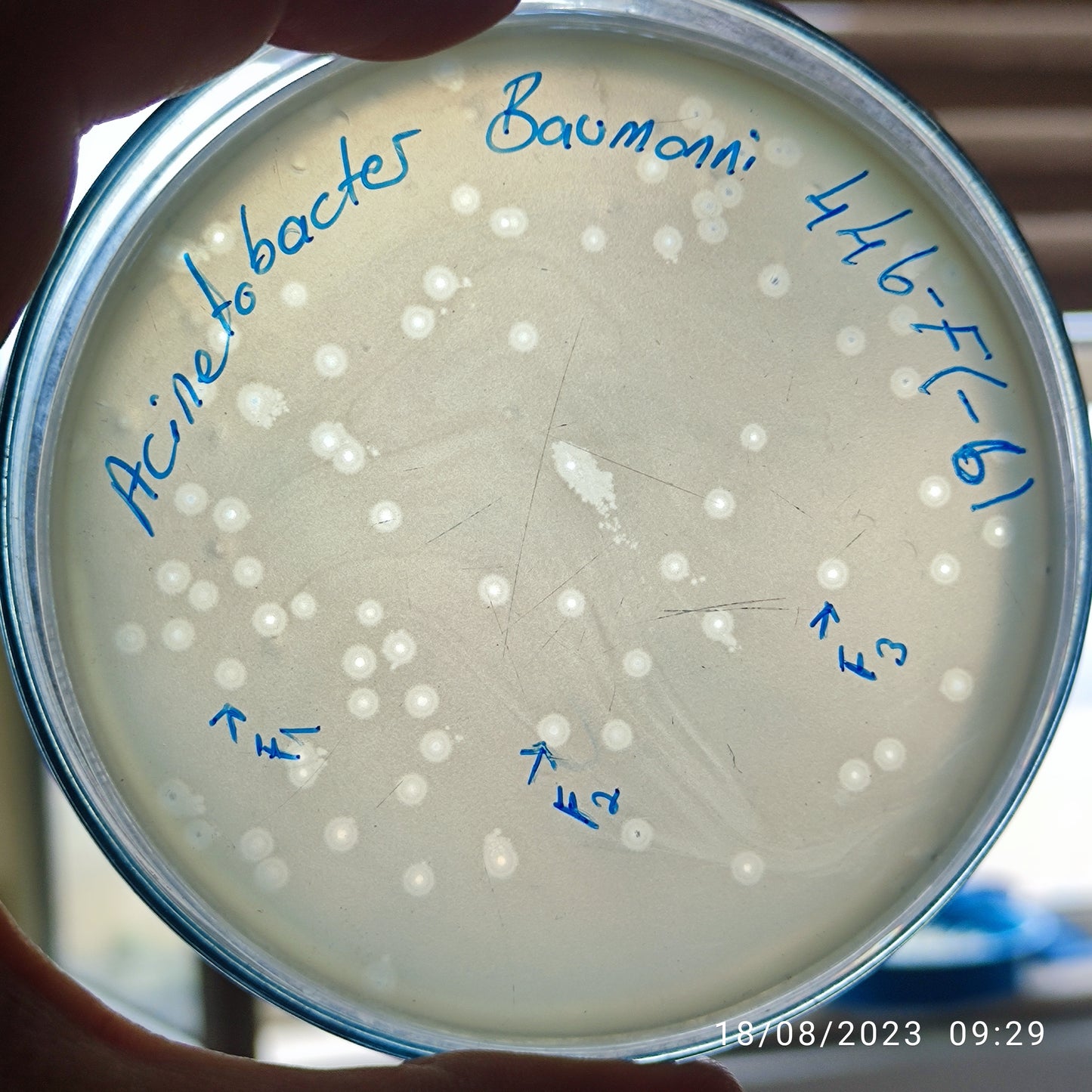 Acinetobacter baumannii bacteriophage 120446F