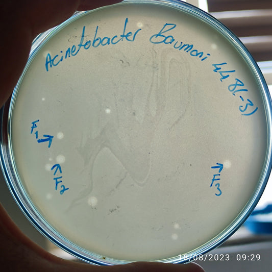 Acinetobacter baumannii bacteriophage 120448F