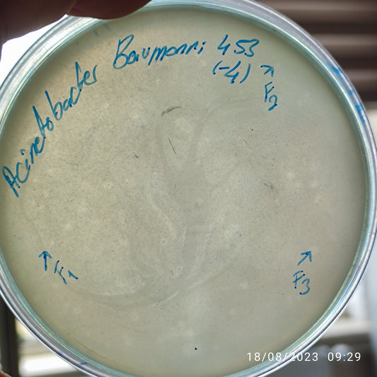 Acinetobacter baumannii bacteriophage 120453F