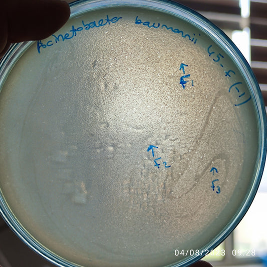 Acinetobacter baumannii bacteriophage 120045F