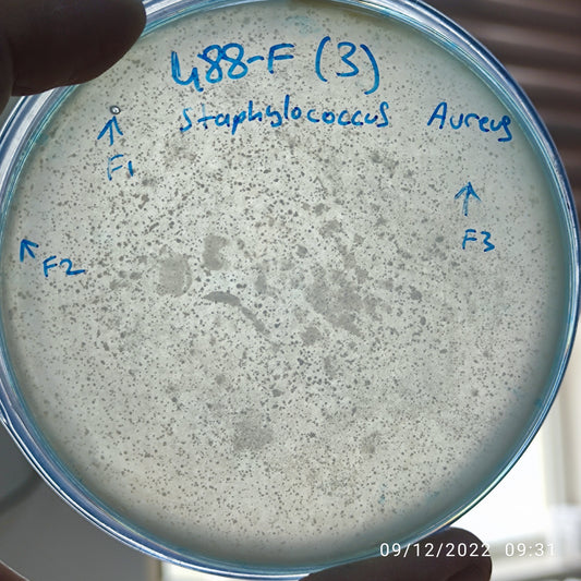 Staphylococcus aureus bacteriophage 152488F