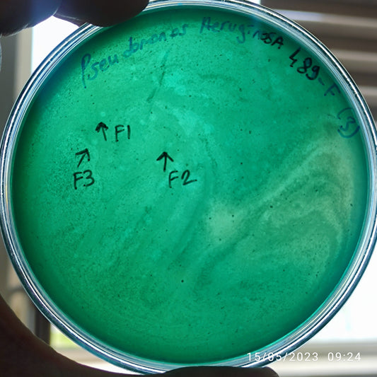 Pseudomonas aeruginosa bacteriophage 130489F
