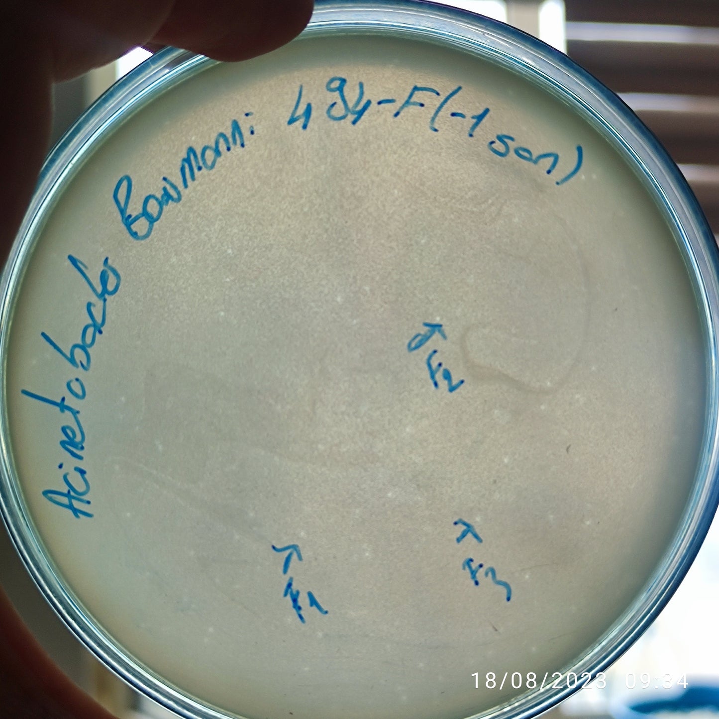 Acinetobacter baumannii bacteriophage 120494F