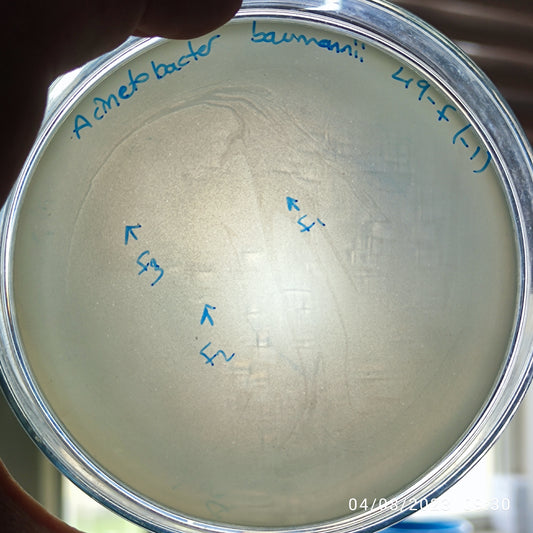 Acinetobacter baumannii bacteriophage 120049F