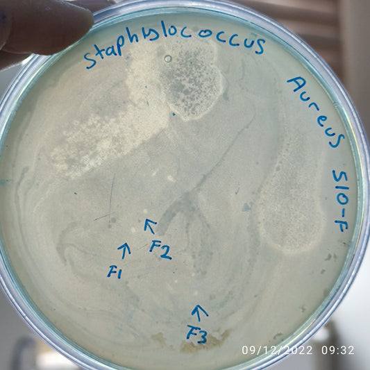 Staphylococcus aureus bacteriophage 152510F