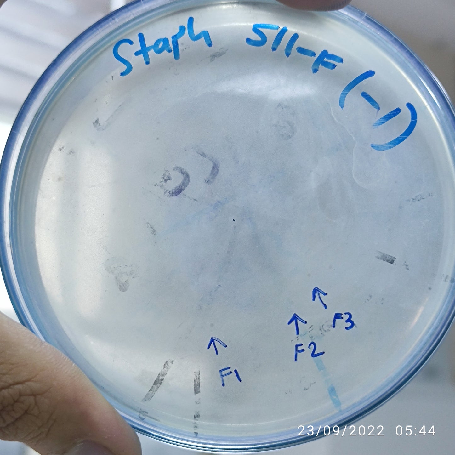 Staphylococcus aureus bacteriophage 152511F