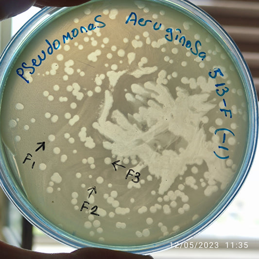 Pseudomonas aeruginosa bacteriophage 130513F