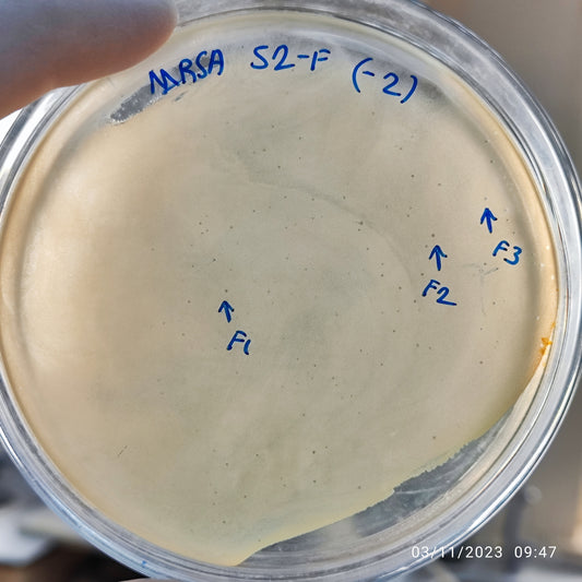 Staphylococcus aureus bacteriophage 150052F