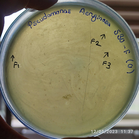 Pseudomonas aeruginosa bacteriophage 130530F
