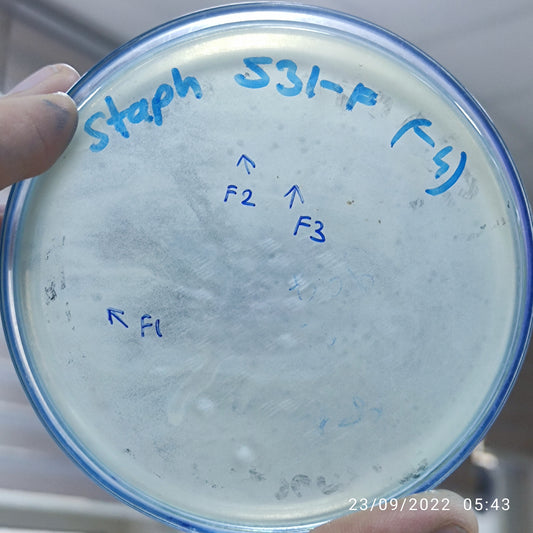 Staphylococcus aureus bacteriophage 152531F