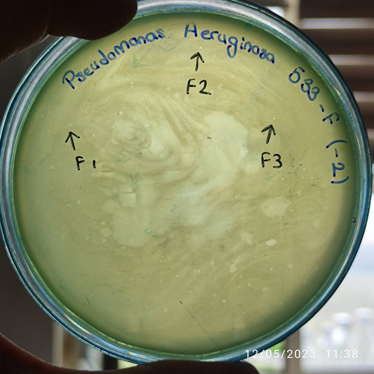 Pseudomonas aeruginosa bacteriophage 130533F