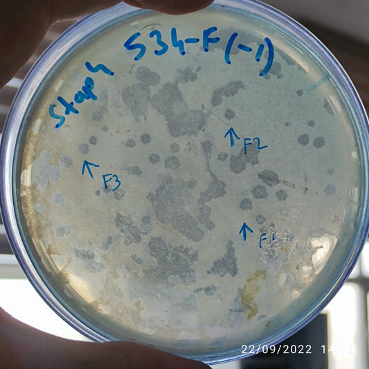 Staphylococcus aureus bacteriophage 152534F