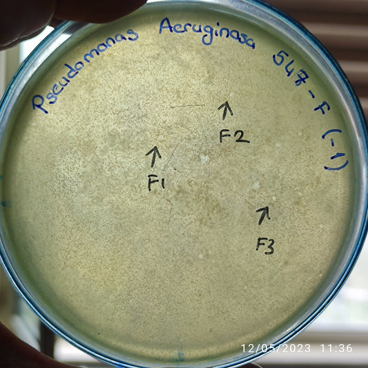 Pseudomonas aeruginosa bacteriophage 130547F