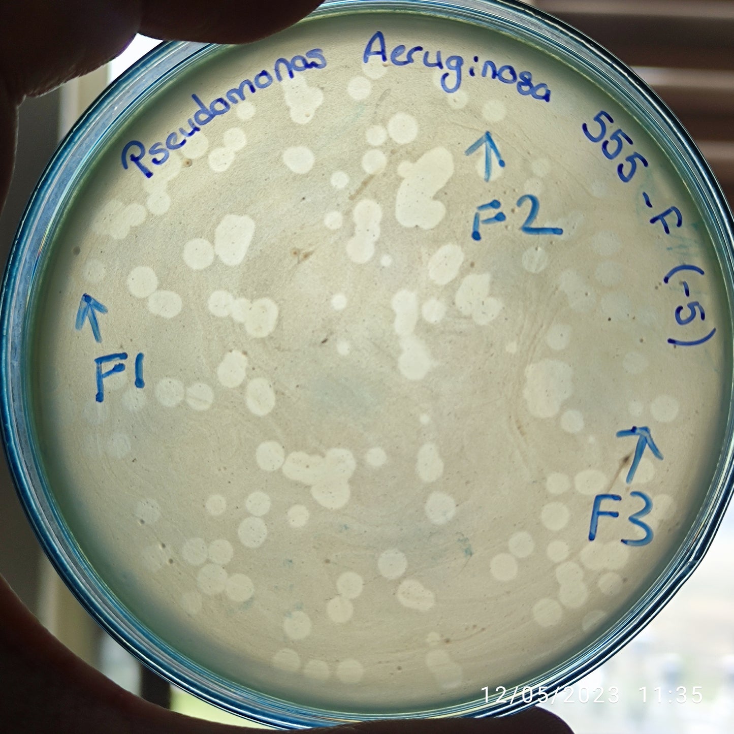 Pseudomonas aeruginosa bacteriophage 130555F