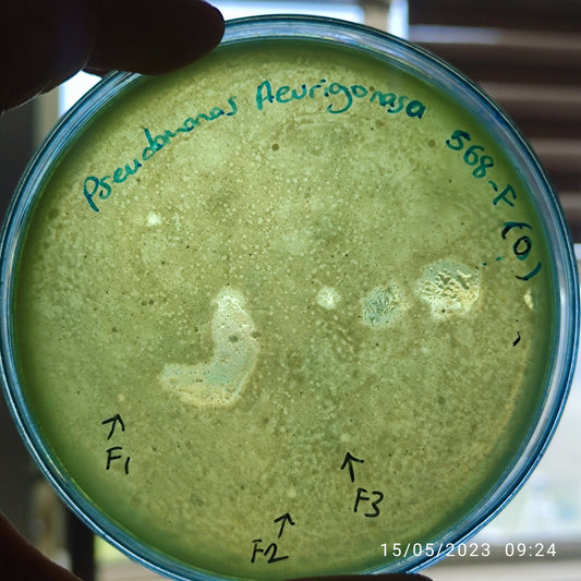 Pseudomonas aeruginosa bacteriophage 130568F