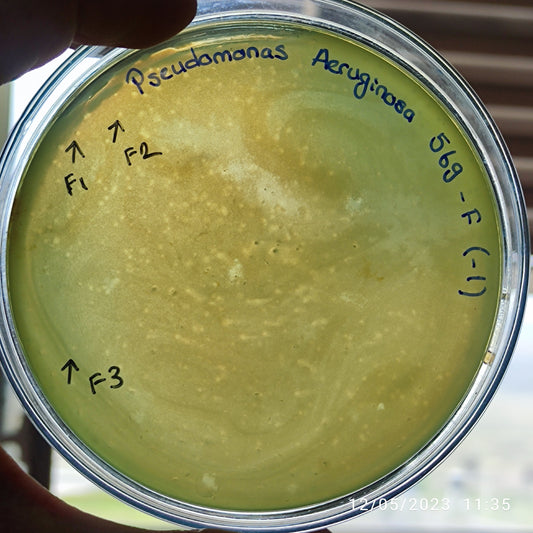 Pseudomonas aeruginosa bacteriophage 130569F