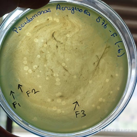 Pseudomonas aeruginosa bacteriophage 130576F