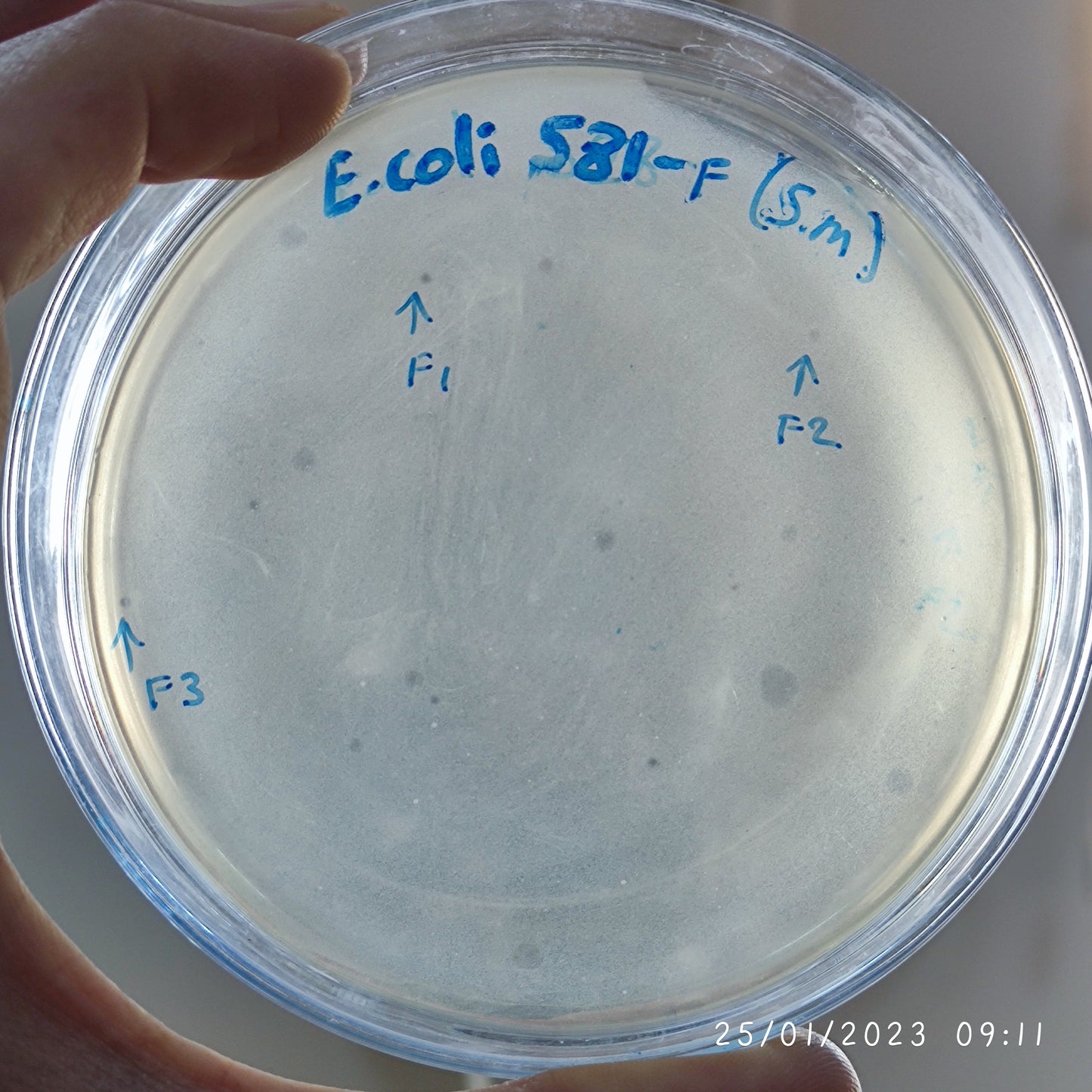 Escherichia coli bacteriophage 100581F