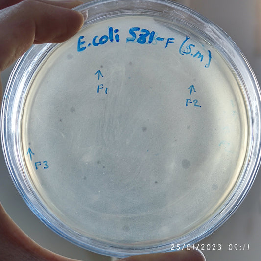 Escherichia coli bacteriophage 100581F