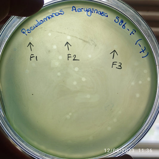 Pseudomonas aeruginosa bacteriophage 130586F