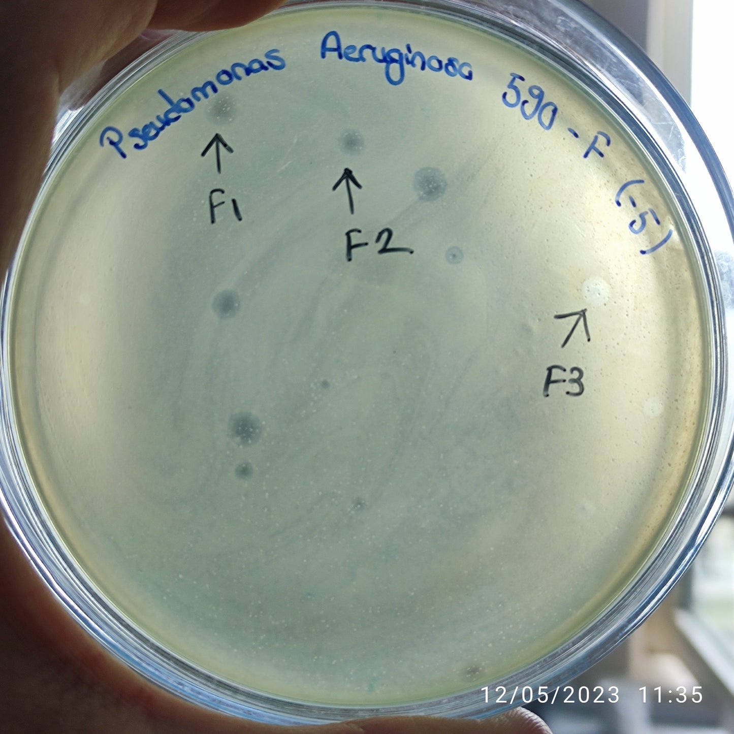 Pseudomonas aeruginosa bacteriophage 130590F