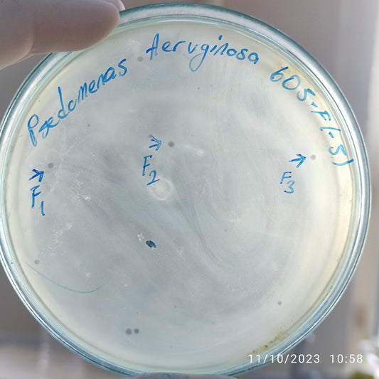 Pseudomonas aeruginosa bacteriophage 130605F